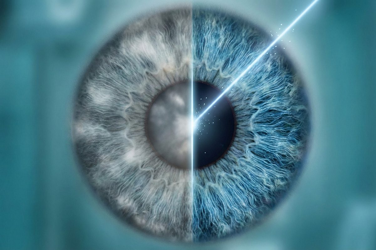 Погляд без туману: чому сучасне лікування катаракти — це швидко, безболісно і необхідно