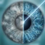 Погляд без туману: чому сучасне лікування катаракти — це швидко, безболісно і необхідно