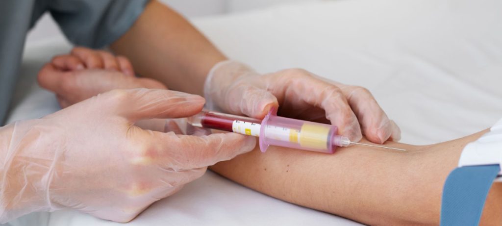 Розшифровка загального аналізу крові: що означають RBC, WBC, PLT і ШОЕ