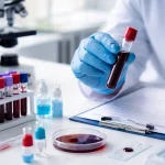 Розшифровка загального аналізу крові: що означають RBC, WBC, PLT і ШОЕ