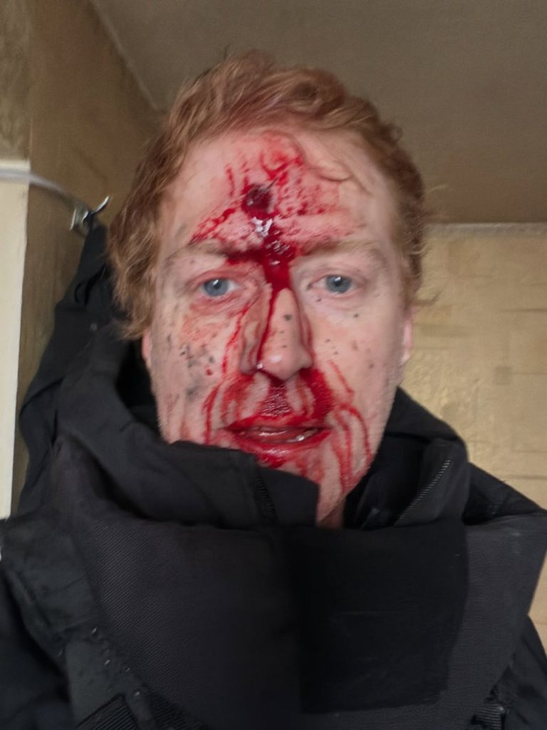 Волонтер Денис Христов «Голландець» потрапив під удар FPV на Куп’янщині